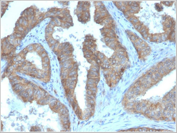 product-image-AAA23949_IHC2.jpg