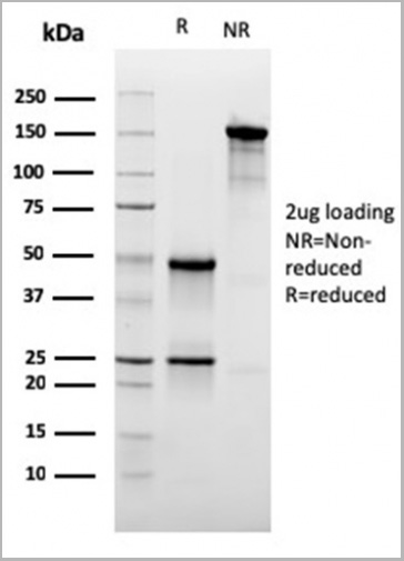 product-image-AAA23949_SDS_PAGE3.jpg