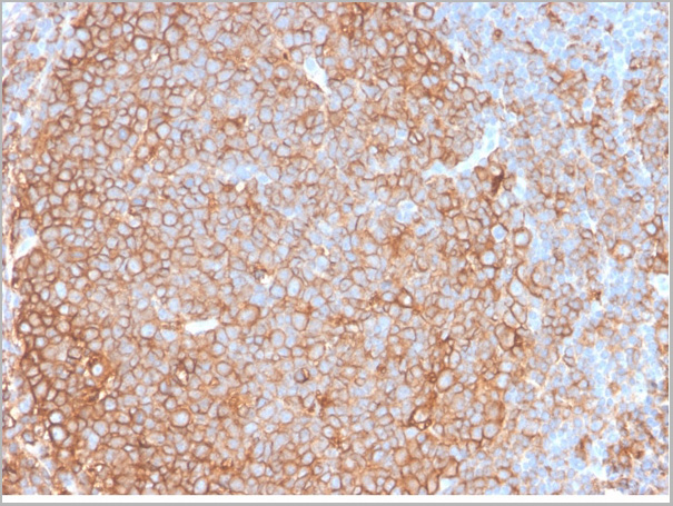 product-image-AAA23950_IHC.jpg