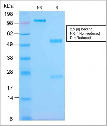 product-image-AAA23950_SDS_PAGE6.jpg