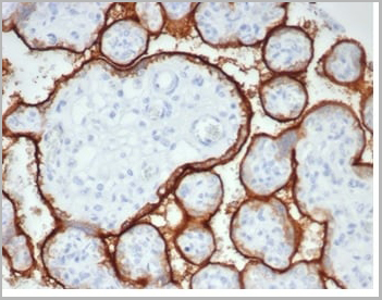 product-image-AAA23954_IHC.jpg
