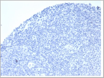 product-image-AAA23954_IHC2.jpg