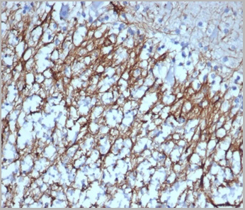 product-image-AAA23955_IHC.jpg