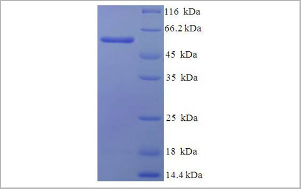 product-image-AAA24008_SDS_PAGE.jpg