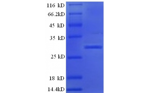 product-image-AAA24013_SDS_PAGE.jpg