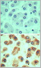 product-image-AAA24064_IHC2.jpg