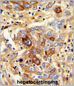 product-image-AAA24067_IHC2.jpg