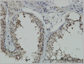 product-image-AAA24832_IHC2.jpg