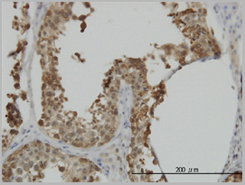 product-image-AAA24833_IHC3.jpg
