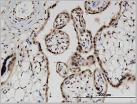 product-image-AAA24920_IHC3.jpg