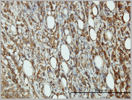 product-image-AAA25089_IHC3.jpg