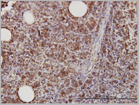 product-image-AAA25344_IHC2.jpg