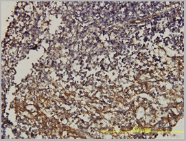 product-image-AAA25344_IHC3.jpg