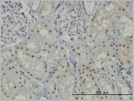product-image-AAA25345_IHC3.jpg