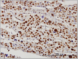 product-image-AAA25857_IHC3.jpg
