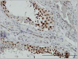product-image-AAA26624_IHC2.jpg