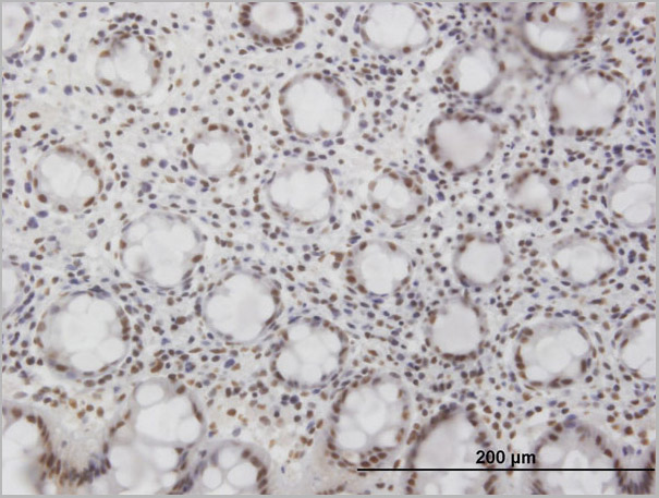 product-image-AAA26625_IHC2.jpg