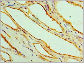product-image-AAA26912_IHC3.jpg