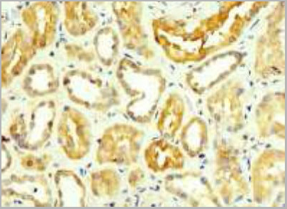 product-image-AAA26912_IHC5.jpg