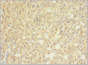 product-image-AAA26913_IHC3.jpg