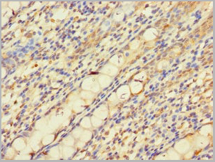 product-image-AAA26917_IHC2.jpg