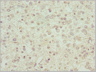 product-image-AAA26919_IHC2.jpg