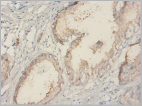 product-image-AAA26920_IHC3.jpg