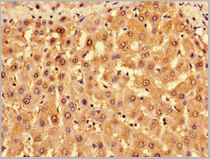 product-image-AAA26920_IHC5.jpg