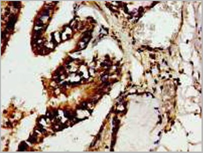 product-image-AAA26920_IHC9.jpg