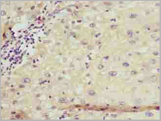 product-image-AAA26923_IHC2.jpg