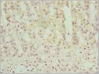 product-image-AAA26923_IHC3.jpg