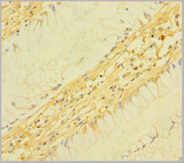 product-image-AAA26926_IHC.jpg