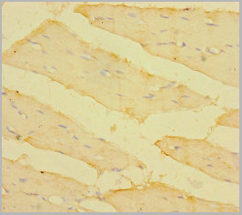 product-image-AAA26926_IHC2.jpg