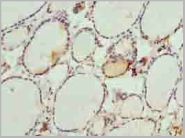 product-image-AAA26927_IHC3.jpg