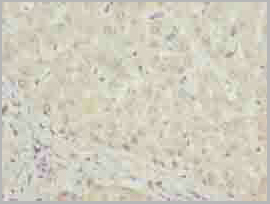 product-image-AAA26927_IHC5.jpg