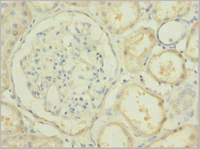 product-image-AAA26928_IHC2.jpg