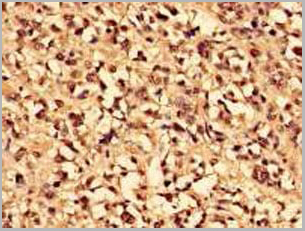 product-image-AAA26929_IHC.jpg