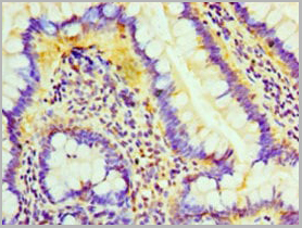 product-image-AAA26930_IHC2.jpg