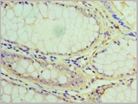 product-image-AAA26930_IHC3.jpg