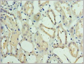 product-image-AAA26931_IHC2.jpg