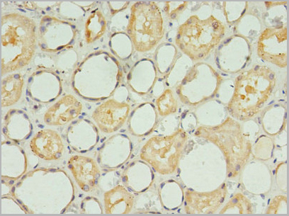 product-image-AAA26933_IHC2.jpg