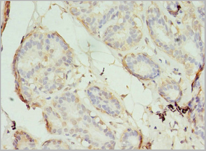 product-image-AAA26933_IHC3.jpg