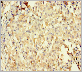 product-image-AAA26935_IHC3.jpg