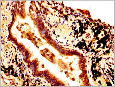product-image-AAA26935_IHC6.jpg