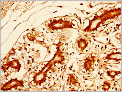 product-image-AAA26935_IHC7.jpg