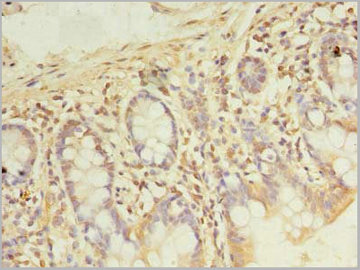 product-image-AAA26936_IHC2.jpg