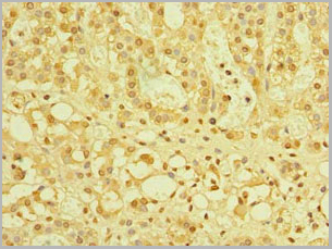 product-image-AAA26942_IHC2.jpg