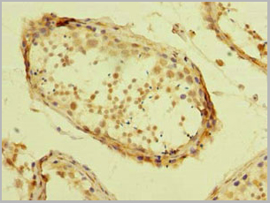 product-image-AAA26942_IHC3.jpg