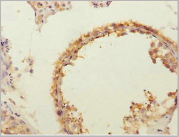 product-image-AAA26950_IHC2.jpg