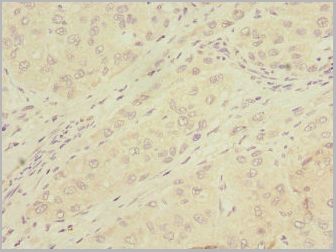 product-image-AAA26951_IHC2.jpg